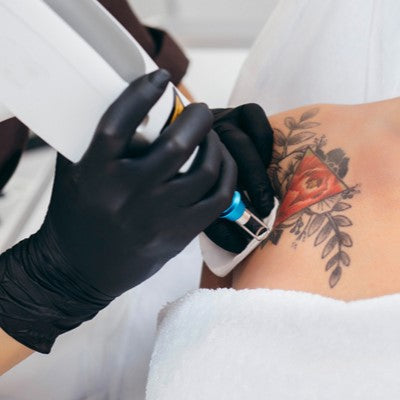 Tattoo Removal Machines