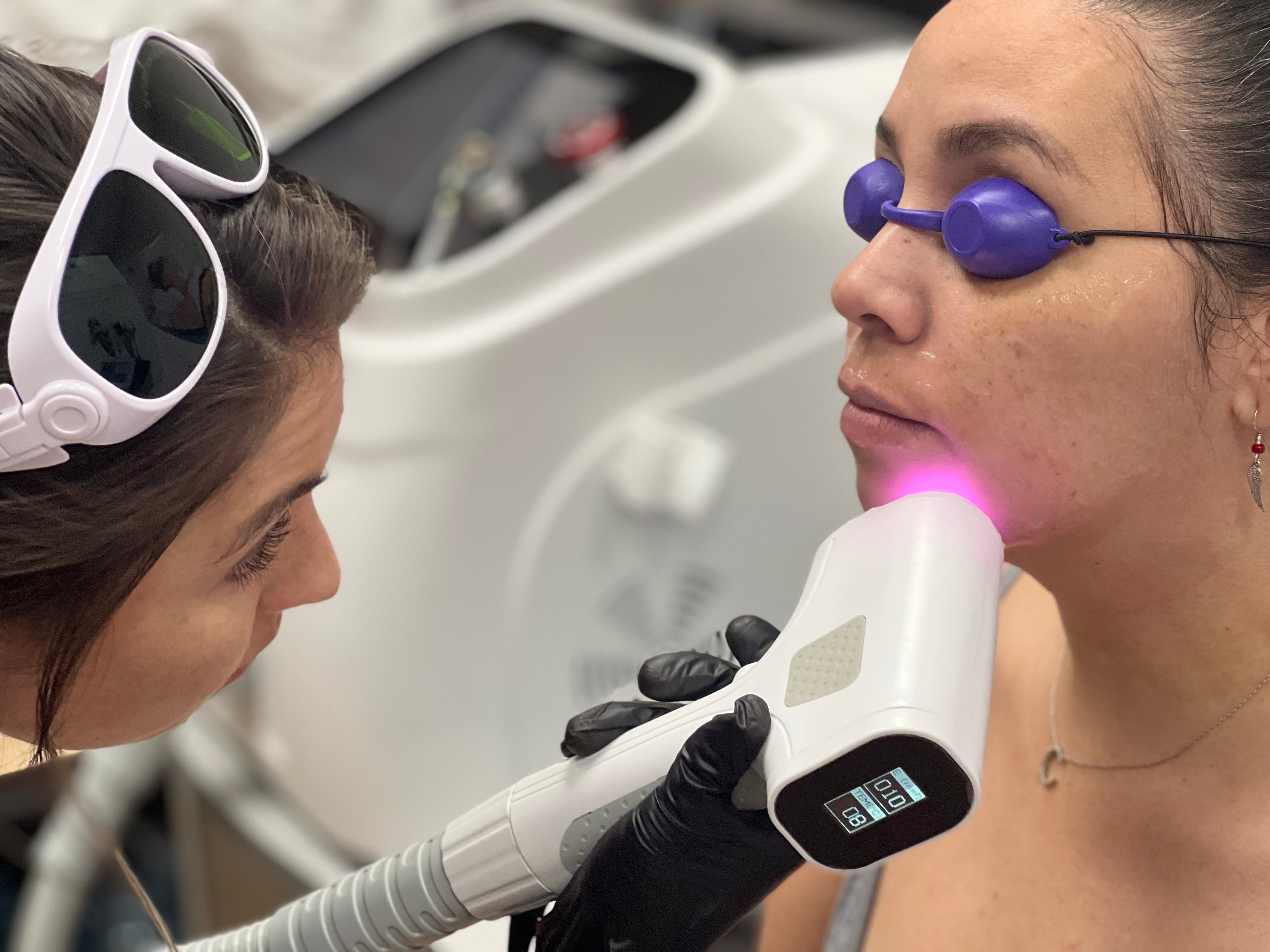 Veloce Diode 2.0 Laser Hair Removal